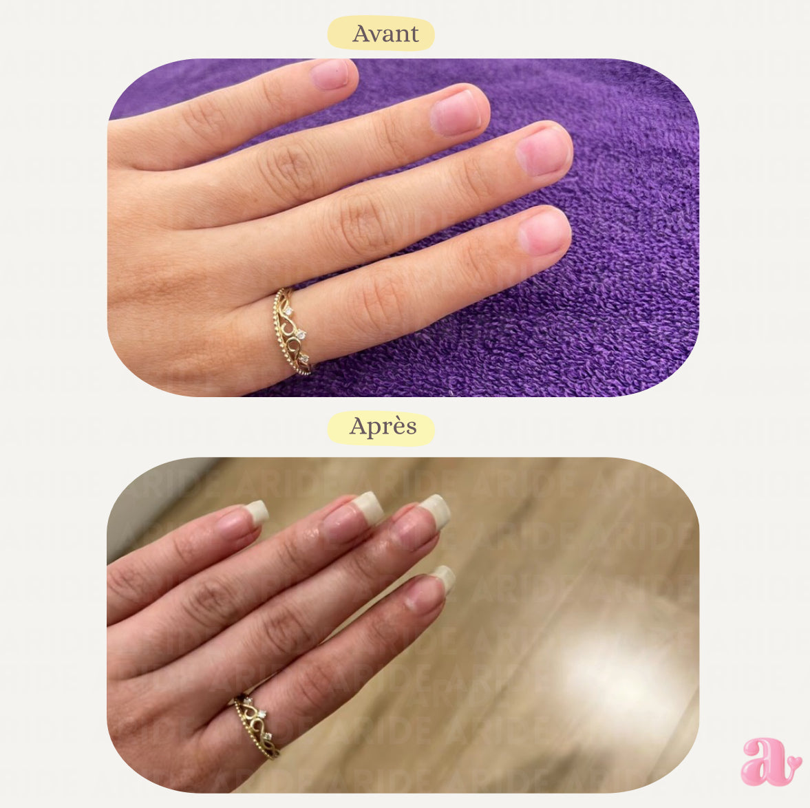 NailPushie - Embellie jusqu’aux ongles en 14 jours