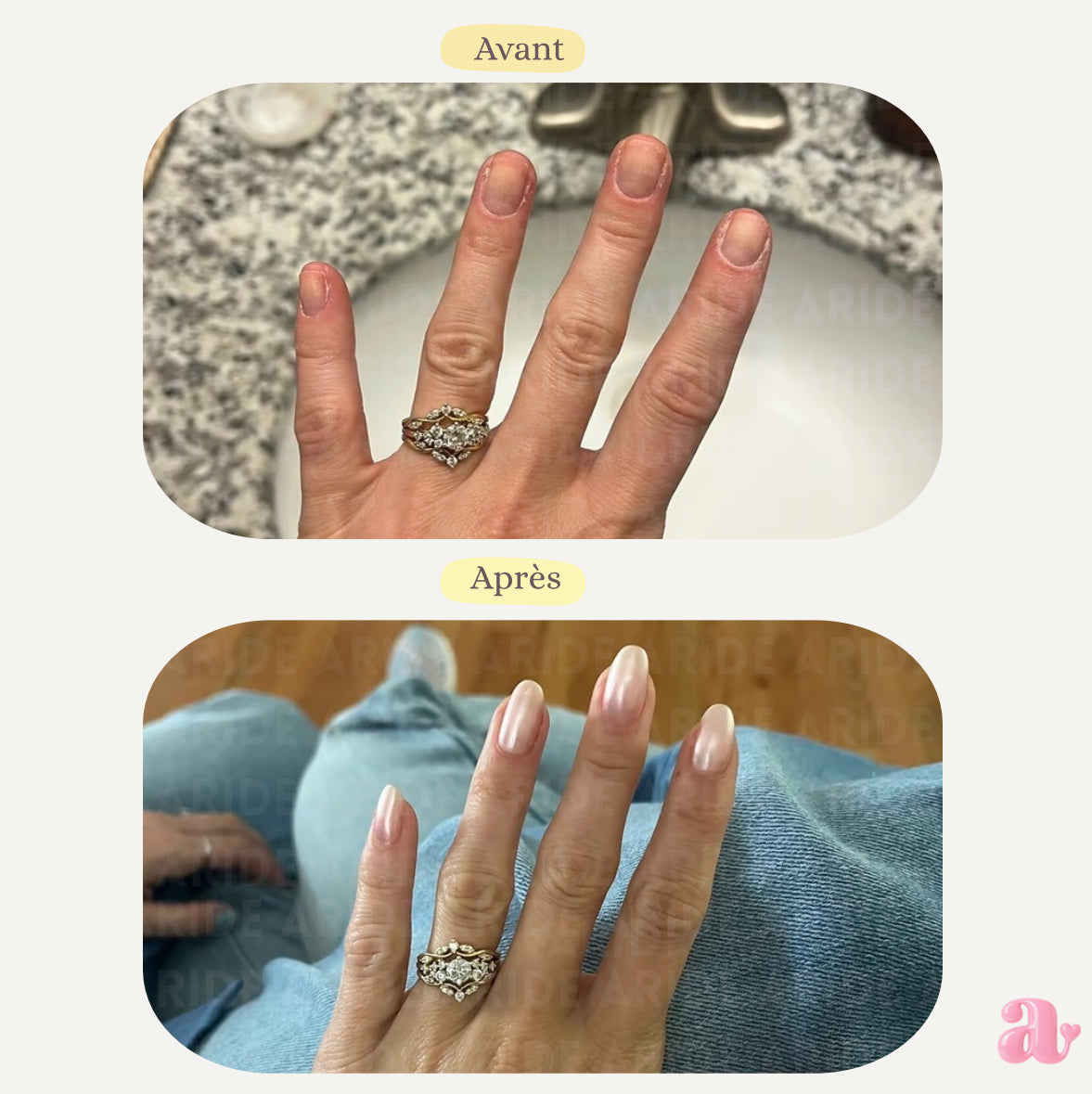 NailPushie - Embellie jusqu’aux ongles en 14 jours